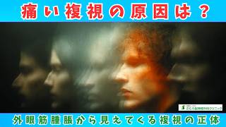 痛い複視の原因は？　外眼筋腫脹から見えてくる複視の正体