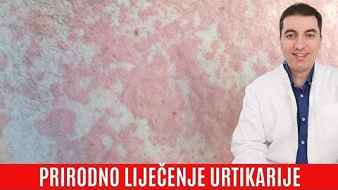 Imate URTIKARIJU (KOPRIVNJAČU)? Ovo će pomoći...