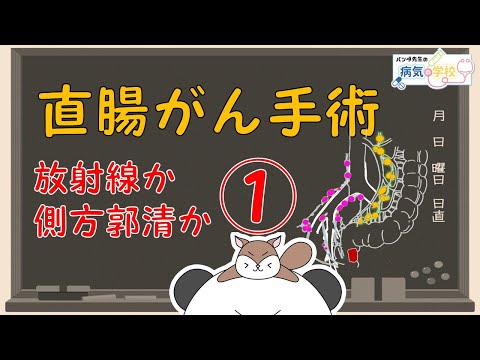 【直腸がんですと言われたら（放射線か側方郭清か！）】