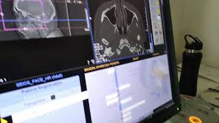 Estágio Técnico Em Radiologia No Crya 2