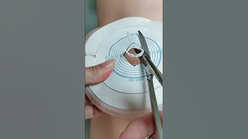 The shape of the stoma is not round, oval and irregular, how to cut the stoma bag