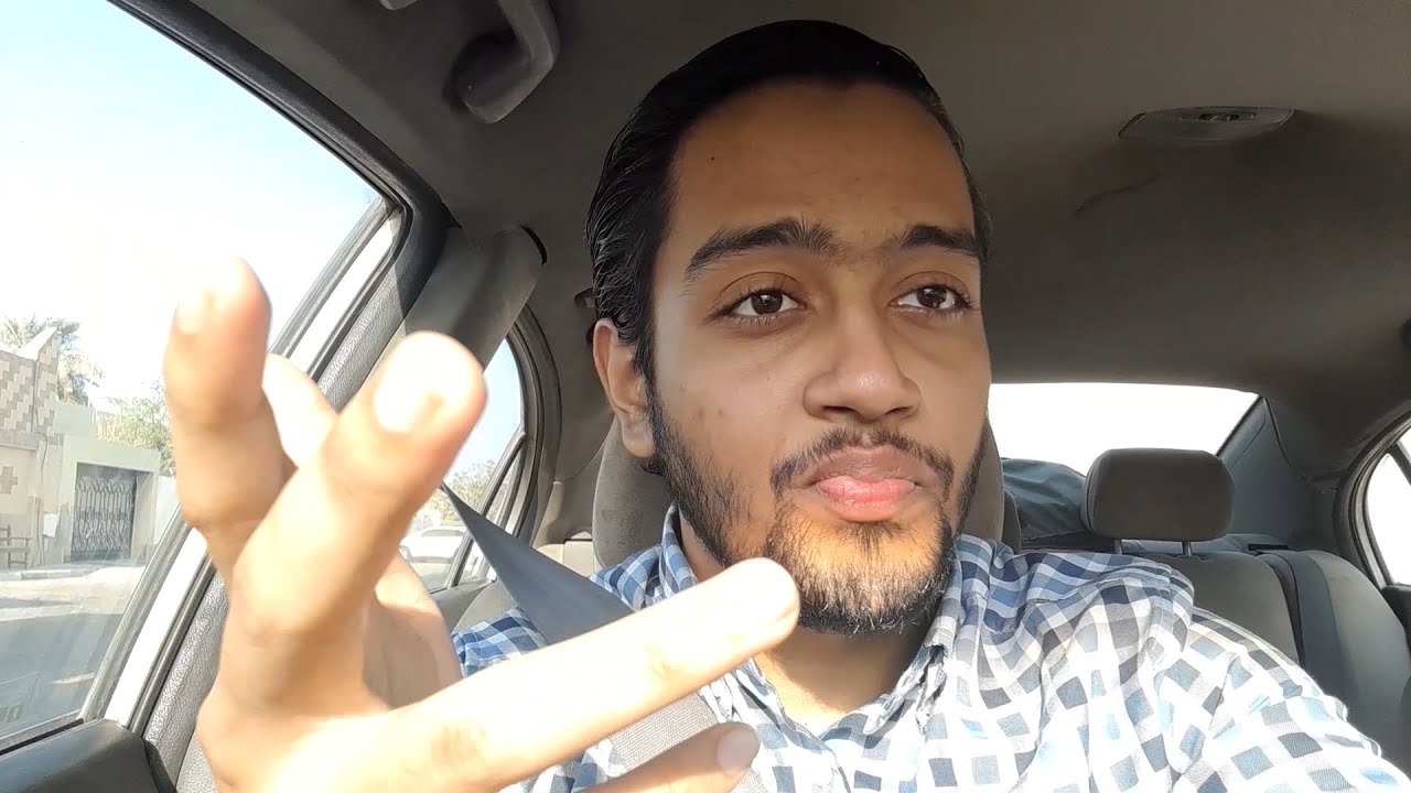 Big Forehead Allegations | No Social Media For a Year | Day 12