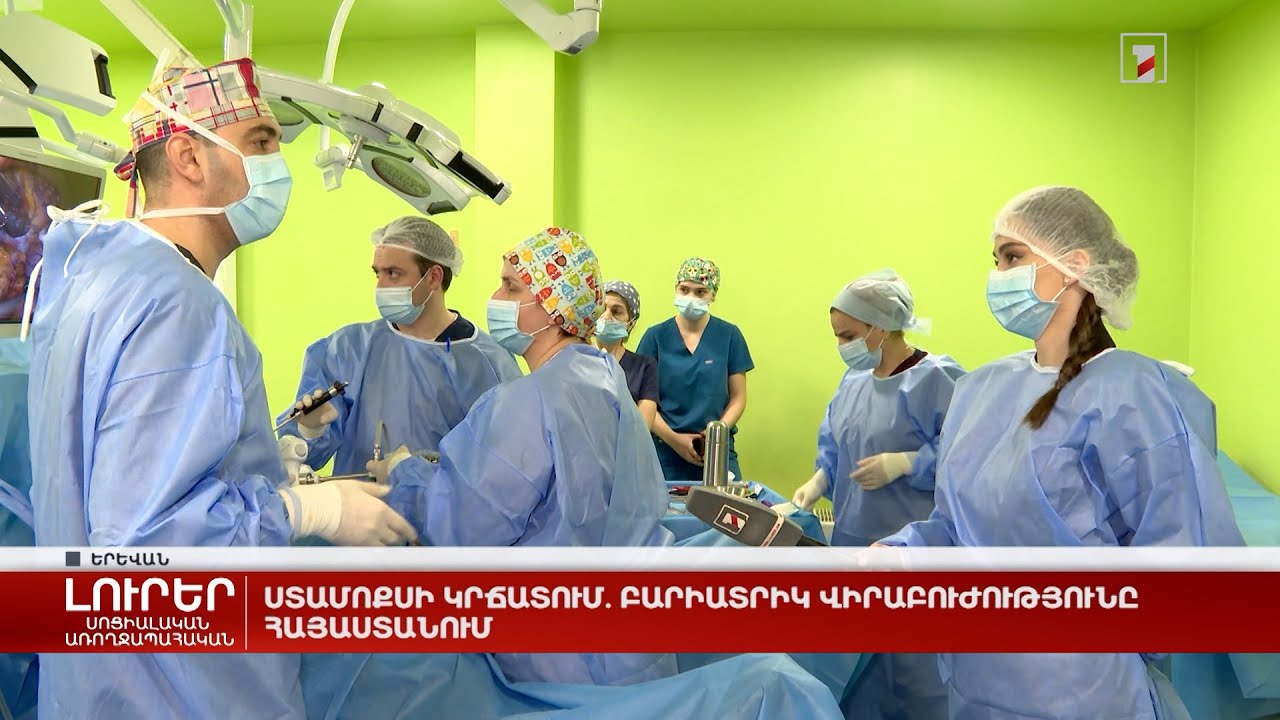 Ստամոքսի կրճատում. բարիատրիկ վիրաբուժությունը Հայաստանում