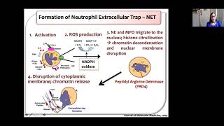 The role of inflammation in amyloidosis - Debora Foguel