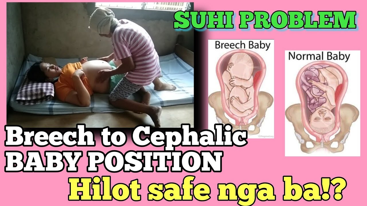 cephalic presentation in 30 weeks pregnancy