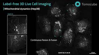 Mitochondrial dynamics - Label-free 3D Live Cell Imaging