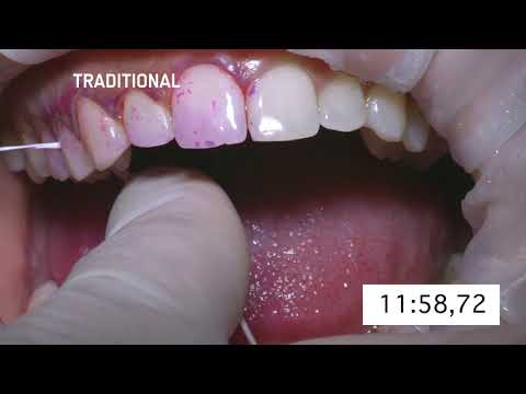 Video: Případ Nadměrného Zubního Ošetření: Je Možné Se Příliš Starat O Zuby Vašeho Mazlíčka?
