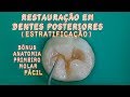 Restauração em Dentes Posteriores ESTRATIFICAÇÃO + BONUS=Anatomia Primeiro molar Fácil