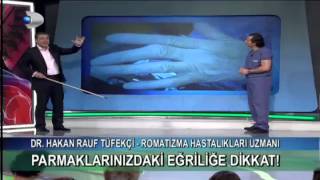 Örneklerle iltihaplı romatizma