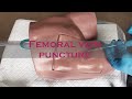 Пункція і катетеризація стегнової вени / Femoral vein puncture ENG subtitles