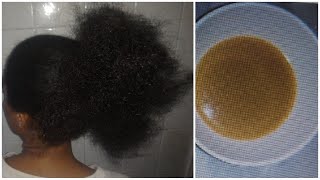 How I Use Ginger and Onion For Unstopable Hair Growth | 4C Hair | Natural Hair screenshot 2