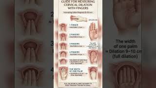 Cervical Dilation by Fingers: 1cm to 10cm Guide | How Midwives Check Labor Progress #mbbs  #nursing