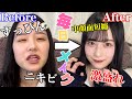【徹底解説】中顔面短縮が命！お嬢様育ち女子高生がリアルにやってる絶対に盛れる毎日メイク！！【大変身】