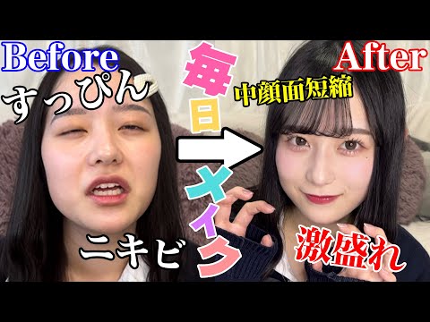 Comprehensive Explanation] Mid-face shortening is key! A high  