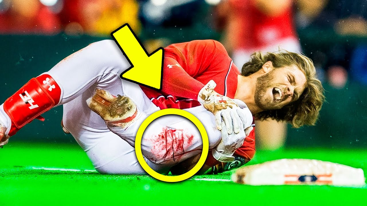MLB MOST SCARY Injuries