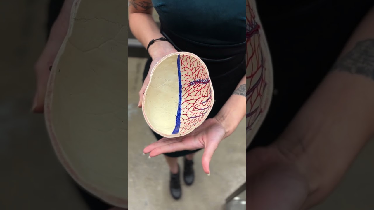 Что такое плагиоцефалия?