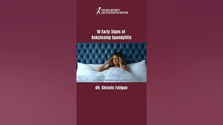 PART 9 | 10 Early Signs of Ankylosing Spondylitis You Shouldn’t Ignore!