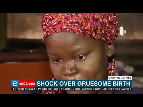 Shock over gruesome birth