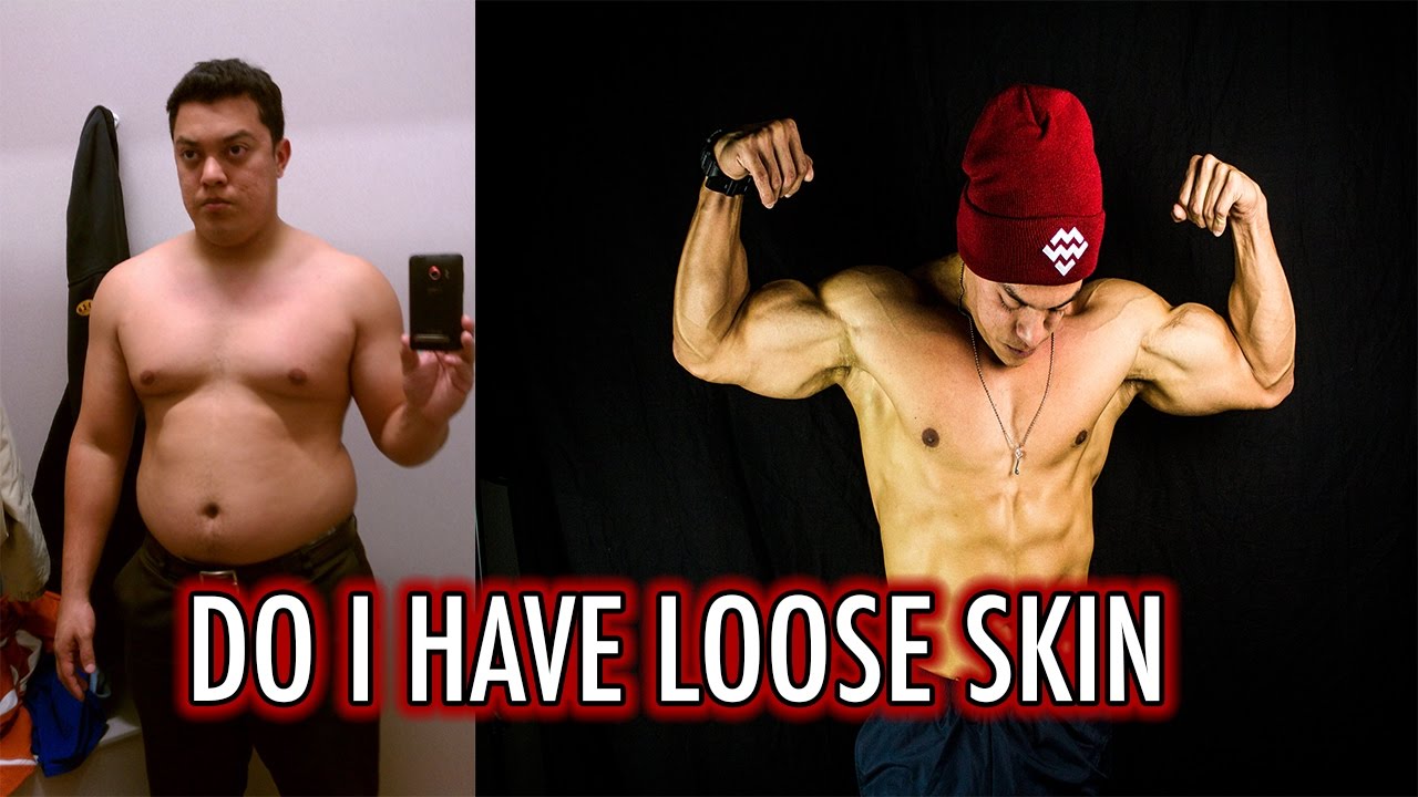 DO I HAVE LOOSE SKIN KETOGENIC DIET VLOG 21 YouTube