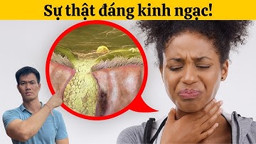 Nguyên nhân THỰC SỰ của tình trạng họng có đờm (chất nhầy) liên tục