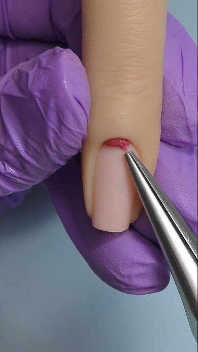 Something is trapped under the cuticle 😱🫣