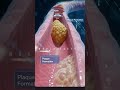 discussion of the heart and heart attack