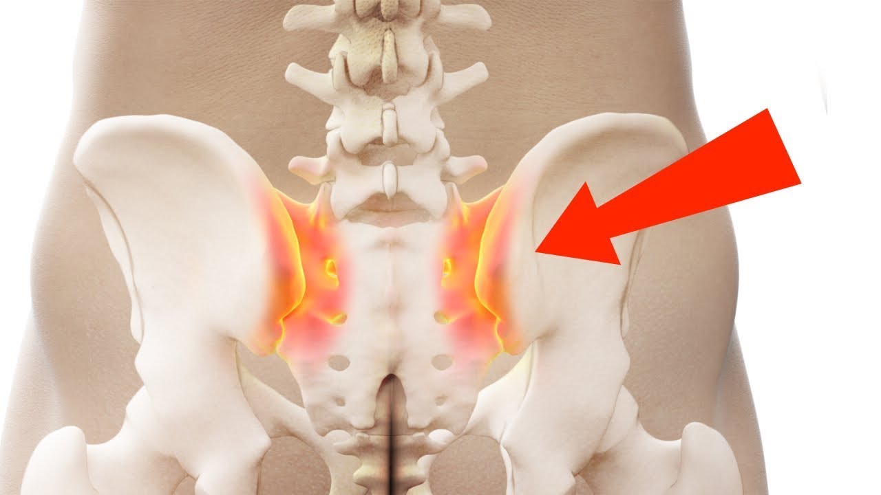 STOP à la douleur sacro-iliaque grâce aux muscles fessiers