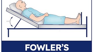 Fowler's Position |patient position
