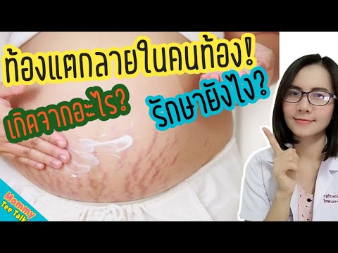 ท้อง ลาย ตั้ง ครรภ์  2022  ท้องแตกลายในคนท้องเกิดจากอะไร​  รักษาอย่างไร?