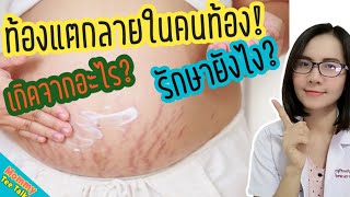 ท้องแตกลายในคนท้องเกิดจากอะไร​  รักษาอย่างไร?