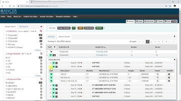 Using the Data Cart in the TCIA Data Portal