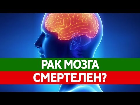 Как РАК МОЗГА может убить тебя? Глиобластома - злокачественная опухоль головного мозга