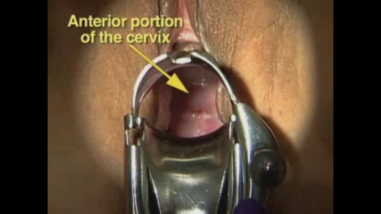 Technique Of Pelvic Examination Youtube