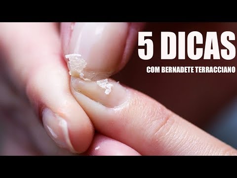 Vídeo: Unhas Descascadas