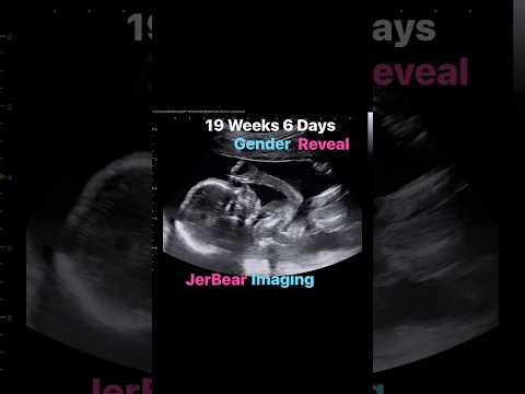 Gender Reveal #jerbearimaging #baby #pregnant #genderreveal
