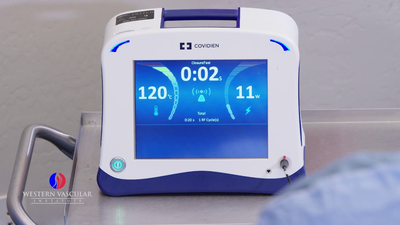 How to treat Varicose Veins? 