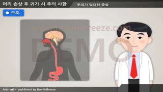 [시연용] d0002abko 머리손상 후 귀가 시 주의사항소아