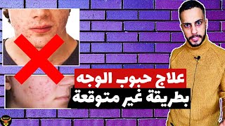 طريقة تشيل بيها حب الشباب مش هتصدق الحل السحري البسيط