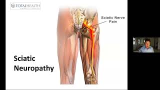 Everything You Need To Know About Sciatica