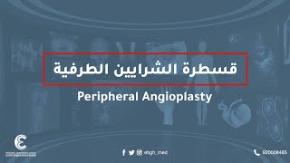 #askEBGHdoctors​ Peripheral Angloplasty | قسطرة الشرايين الطرفية #استفسر_من_طبيبك​ screenshot 3