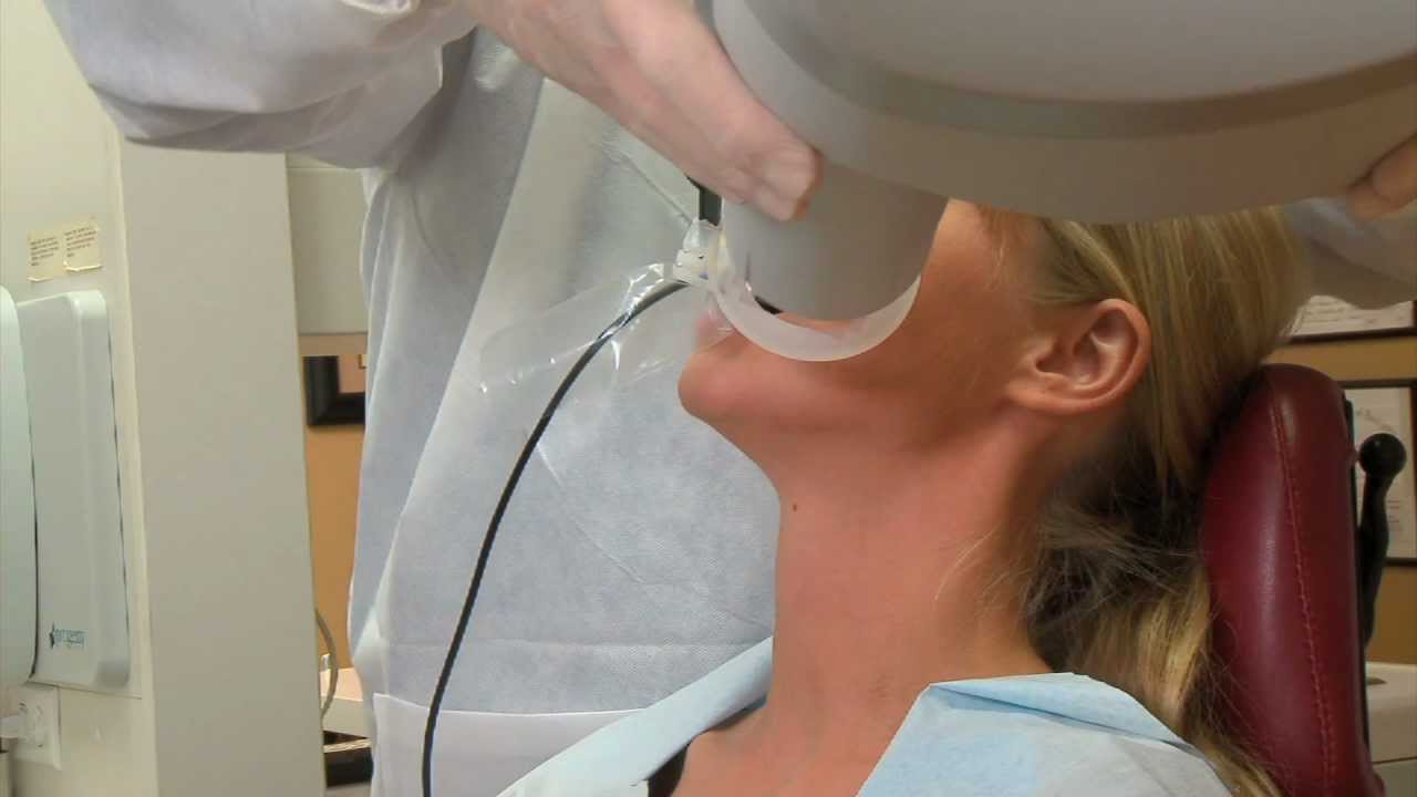 TrollByte Kimera Red -- Horizontal Bitewings.mp4