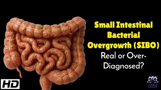 Small Intestinal Bacterial Overgrowth ( SIBO )  : Real or Over Diagnosed?