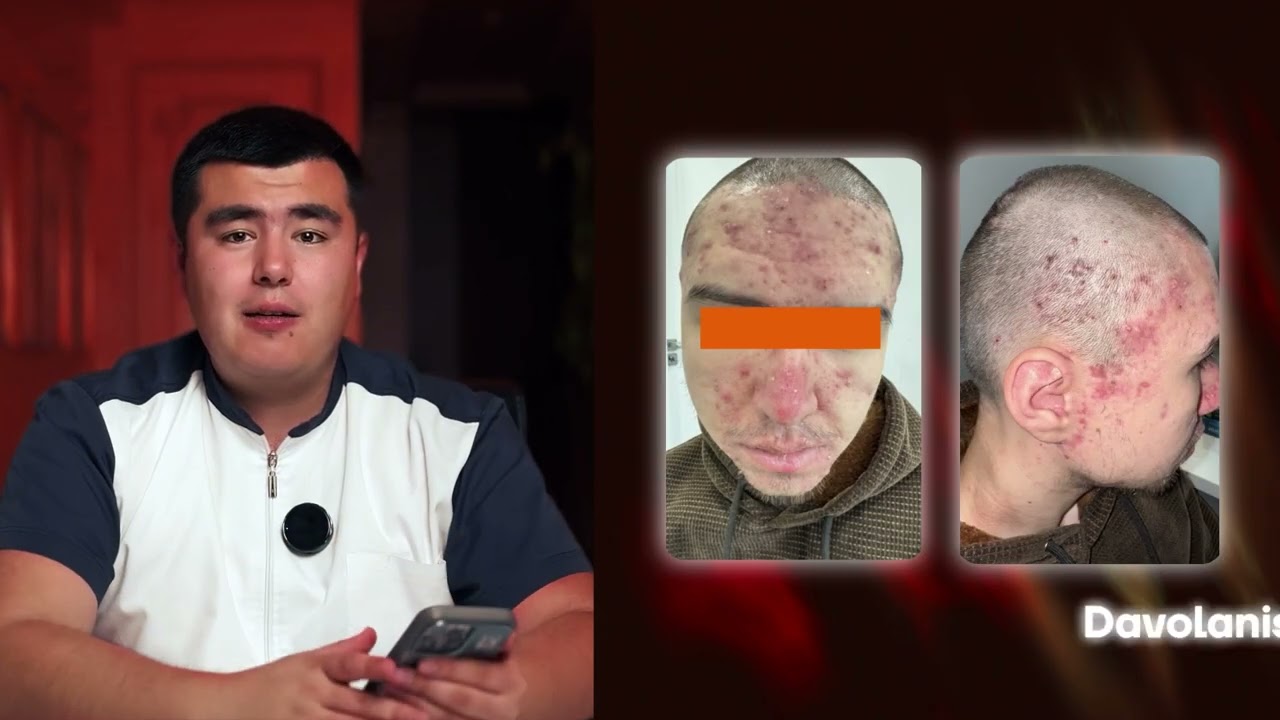 Ugrilar qutulish uchun nima qilish kerak? Natijaga erishgan bemorlar haqida