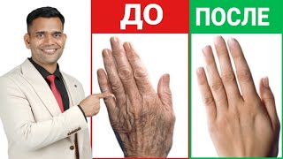 картинка: 1 СРЕДСТВО ОТ МОРЩИН НА РУКАХ И ПИГМЕНТНЫХ ПЯТЕН.