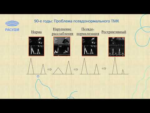 Эхокардиография в оценке диастолической функции