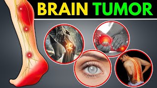 Famous Don't Ignore These 8 Early Brain Tumor Warning Signs Wealth