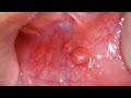 @DentArtzz 🦷🦷🦷🦷🦷🦷🦷