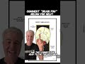 Find relief from head pressure in Riverview | occipital neuralgia treatment brandon