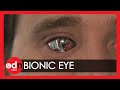 Man sees with 'bionic eye'