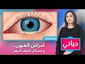 حياتي أمراض العيون و مشاكل ضعف البصر 
